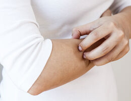 A hand scratches an arm.